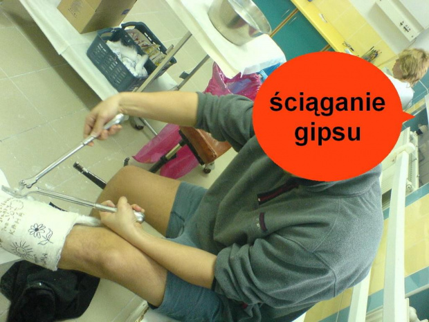 sciaganie gipsa